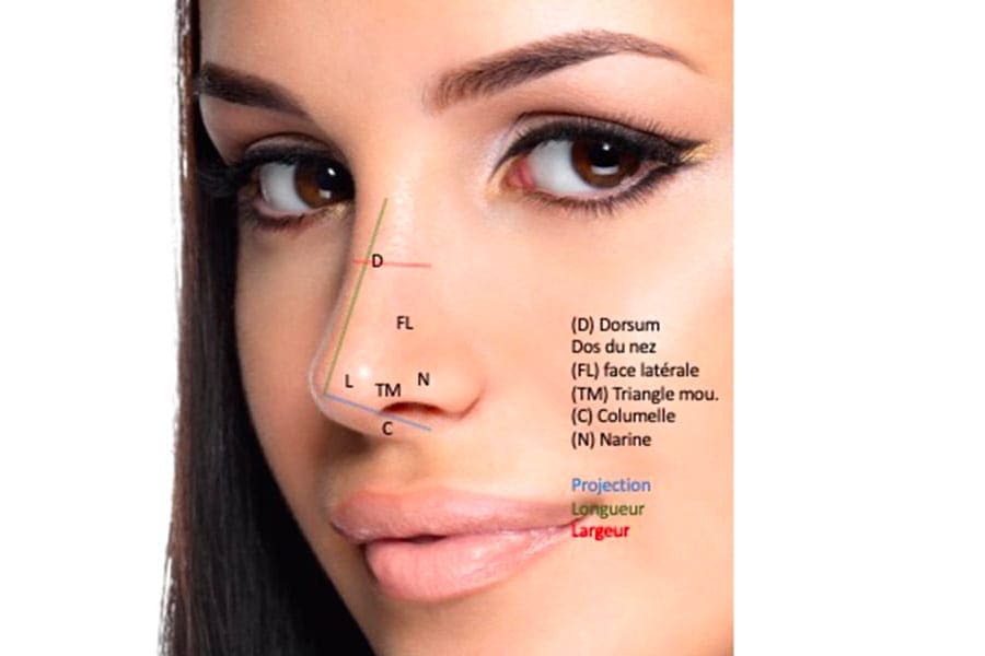 remplacement prothese mammaire prix chirurgie mammaire chirurgie esthetique paris dr philippe pelissier chirurgien plasticien esthetique paris