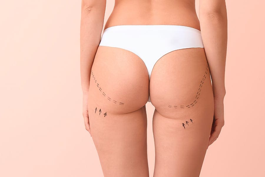 remplacement prothese mammaire prix chirurgie mammaire chirurgie esthetique paris dr philippe pelissier chirurgien plasticien esthetique paris