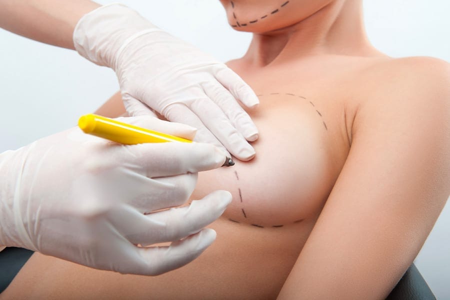 remplacement prothese mammaire prix chirurgie mammaire chirurgie esthetique paris dr philippe pelissier chirurgien plasticien esthetique paris
