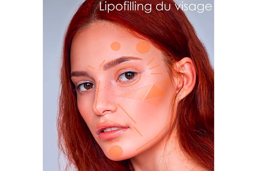 remplacement prothese mammaire prix chirurgie mammaire chirurgie esthetique paris dr philippe pelissier chirurgien plasticien esthetique paris